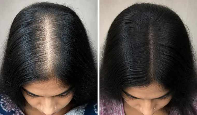 Top-down comparison of a widening middle part beside a narrower, denser-looking part